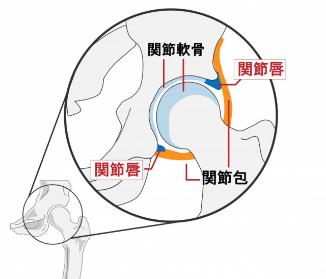 股関節 写真