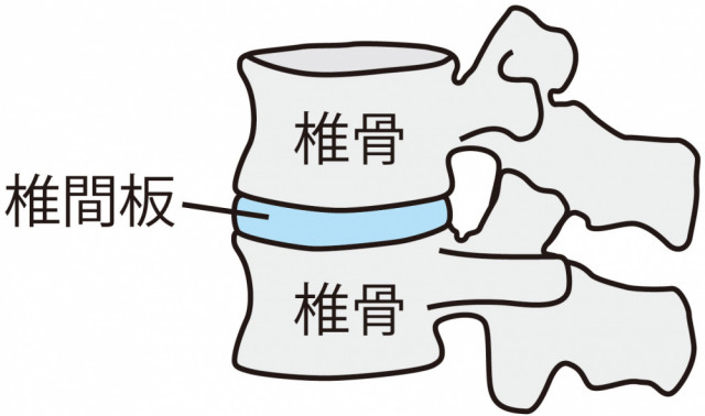 頚椎症とは?